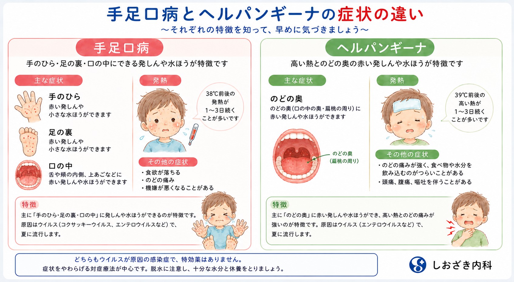 手足口病とヘルパンギーナの症状の違い：手足口病は手のひら・足の裏・口の中に発しんや水ほうができ38℃前後の発熱、ヘルパンギーナはのどの奥に発しんや水ほうができ39℃前後の高熱が特徴